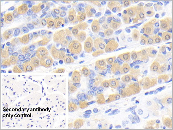 product-image-AAA21231_IHC6.jpg