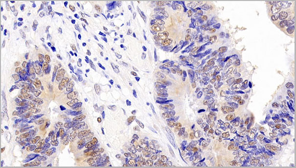 product-image-AAA21232_IHC2.jpg