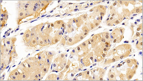 product-image-AAA21232_IHC3.jpg
