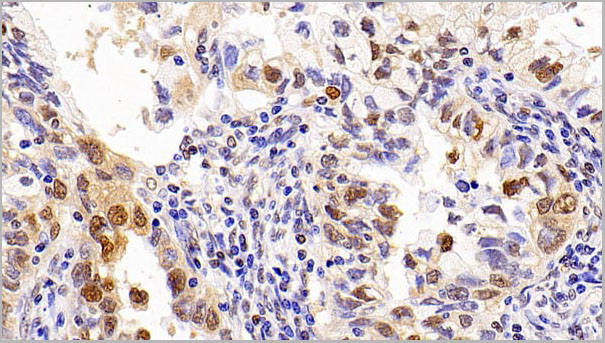 product-image-AAA21232_IHC4.jpg