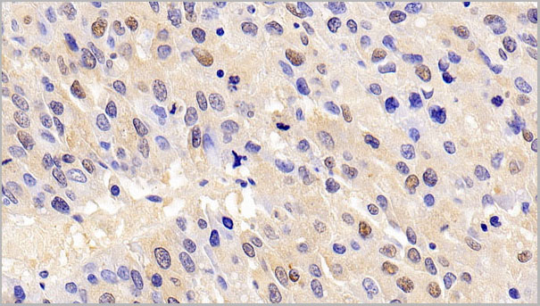 product-image-AAA21232_IHC6.jpg