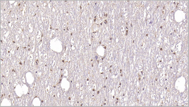 product-image-AAA21234_IHC.jpg