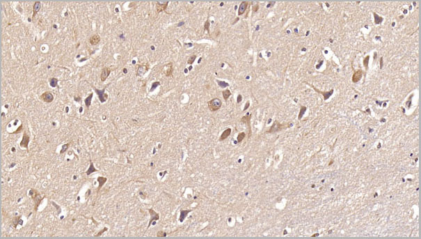 product-image-AAA21234_IHC2.jpg