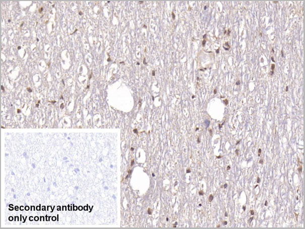 product-image-AAA21234_IHC4.jpg