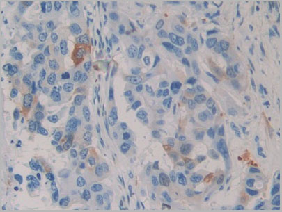 product-image-AAA21235_IHC.jpg