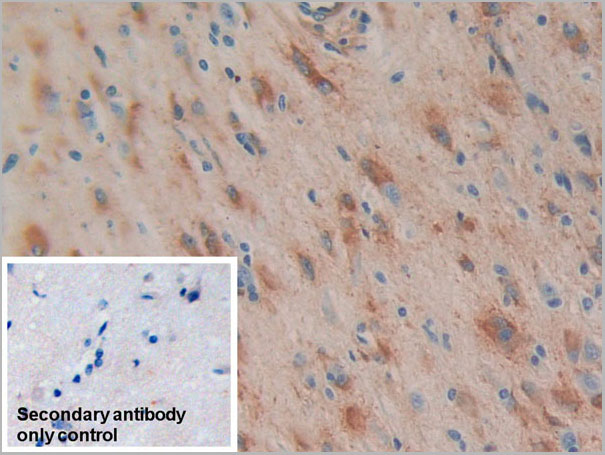 product-image-AAA21235_IHC2.jpg