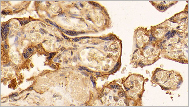 product-image-AAA21236_IHC.jpg