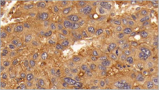 product-image-AAA21236_IHC2.jpg
