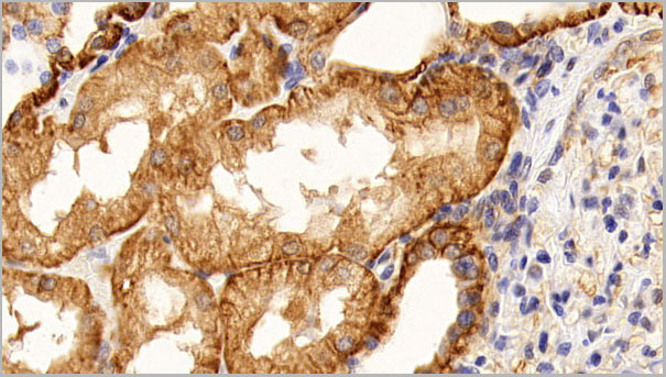 product-image-AAA21236_IHC3.jpg