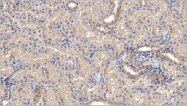 product-image-AAA21236_IHC4.jpg