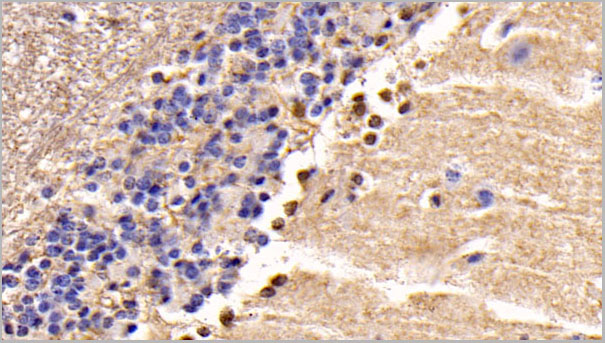 product-image-AAA21237_IHC.jpg