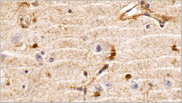 product-image-AAA21237_IHC2.jpg