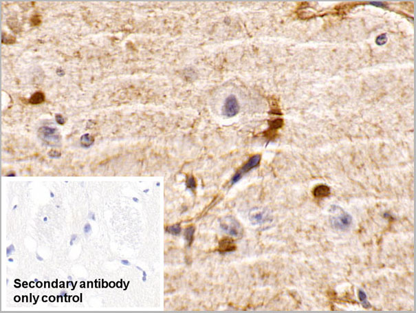 product-image-AAA21237_IHC3.jpg
