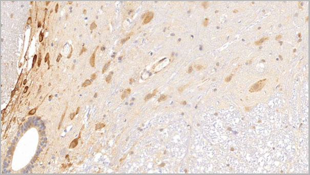 product-image-AAA21238_IHC2.jpg