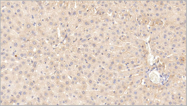 product-image-AAA21238_IHC5.jpg