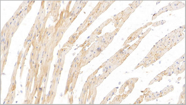 product-image-AAA21238_IHC6.jpg