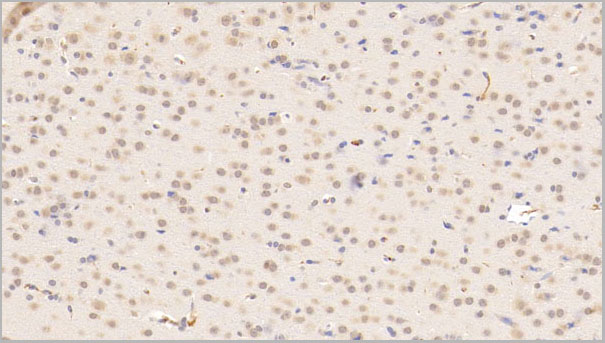 product-image-AAA21238_IHC7.jpg