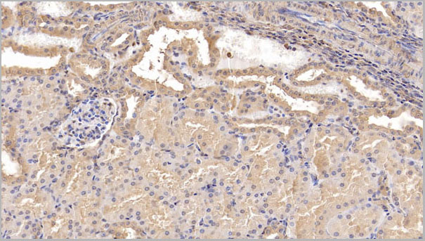 product-image-AAA21240_IHC2.jpg