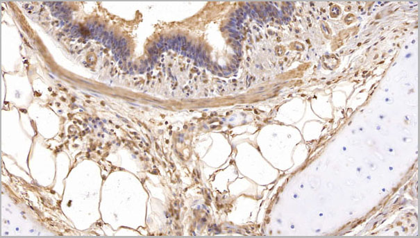 product-image-AAA21240_IHC3.jpg