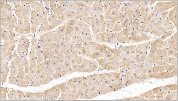product-image-AAA21240_IHC4.jpg
