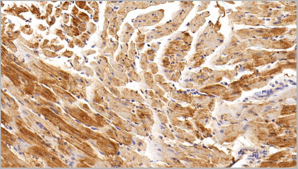 product-image-AAA21241_IHC2.jpg
