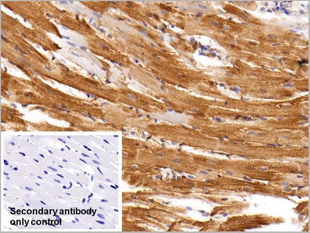 product-image-AAA21241_IHC3.jpg