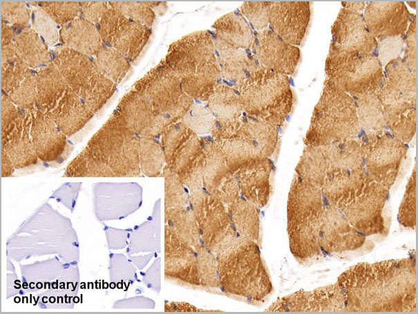 product-image-AAA21241_IHC4.jpg