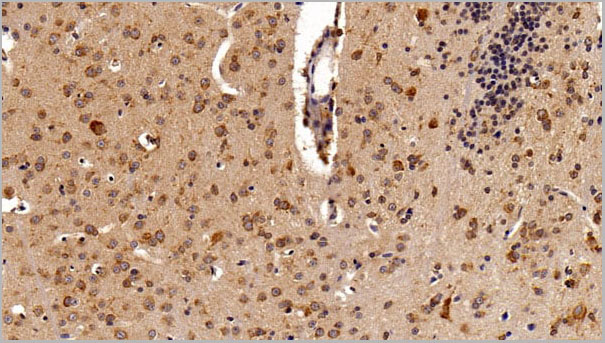 product-image-AAA21242_IHC4.jpg