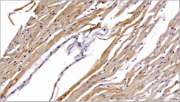 product-image-AAA21242_IHC5.jpg