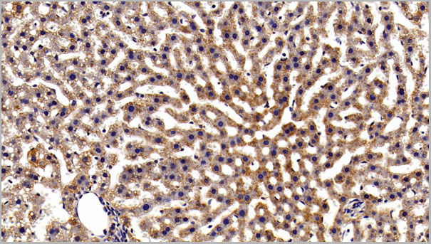 product-image-AAA21242_IHC6.jpg