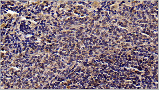product-image-AAA21243_IHC2.jpg