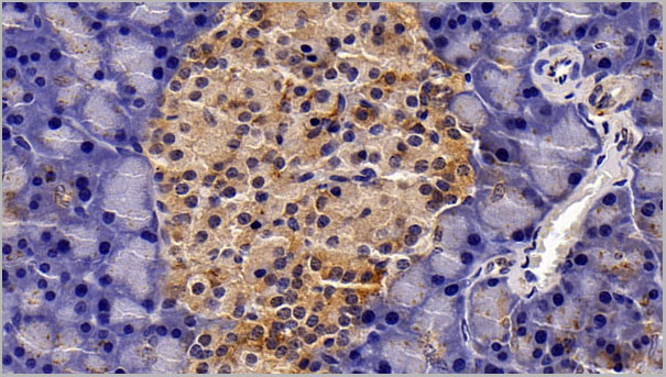 product-image-AAA21243_IHC3.jpg