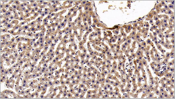 product-image-AAA21243_IHC4.jpg