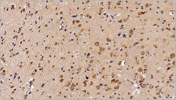 product-image-AAA21243_IHC5.jpg