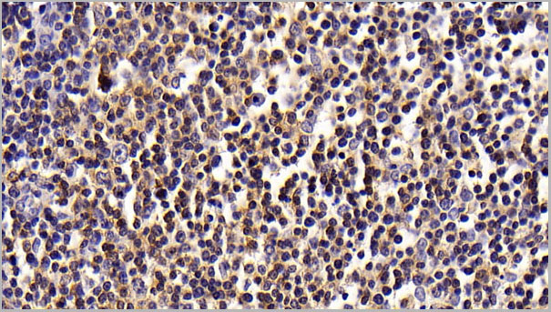 product-image-AAA21245_IHC3.jpg
