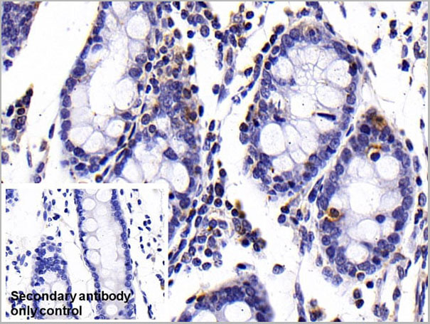 product-image-AAA21245_IHC4.jpg