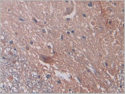 product-image-AAA21247_IHC.jpg