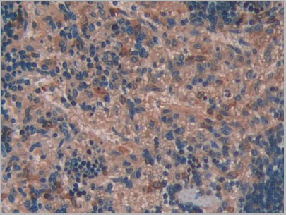 product-image-AAA21247_IHC2.jpg