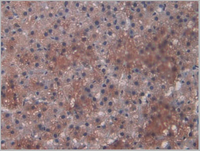 product-image-AAA21247_IHC4.jpg