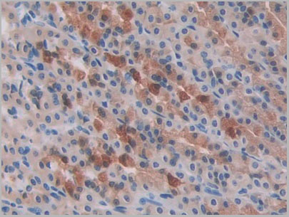 product-image-AAA21247_IHC5.jpg