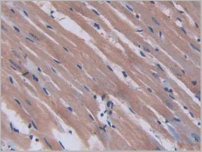 product-image-AAA21247_IHC6.jpg