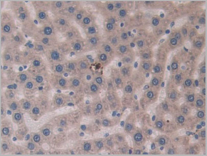 product-image-AAA21247_IHC7.jpg
