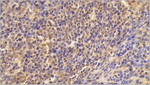 product-image-AAA21248_IHC2.jpg