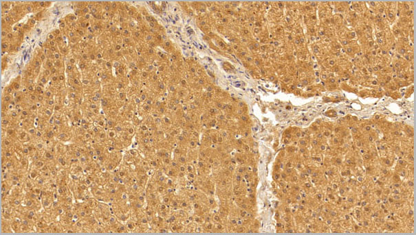 product-image-AAA21248_IHC6.jpg