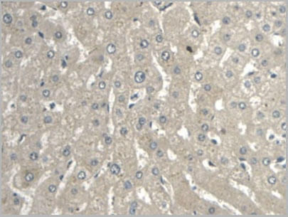 product-image-AAA21249_IHC4.jpg
