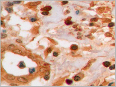 product-image-AAA21250_IHC.jpg