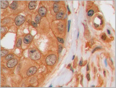 product-image-AAA21250_IHC2.jpg