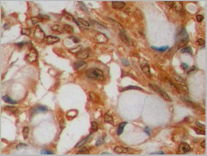 product-image-AAA21250_IHC4.jpg