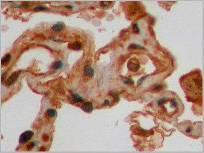 product-image-AAA21250_IHC5.jpg