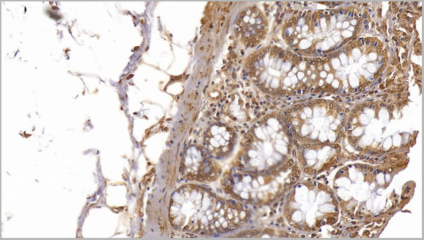 product-image-AAA21250_IHC6.jpg